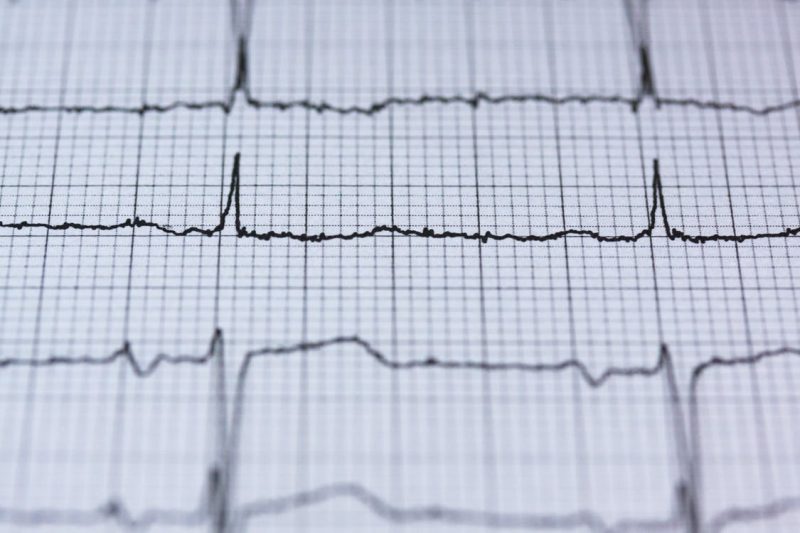 Heart-Rate-Graph