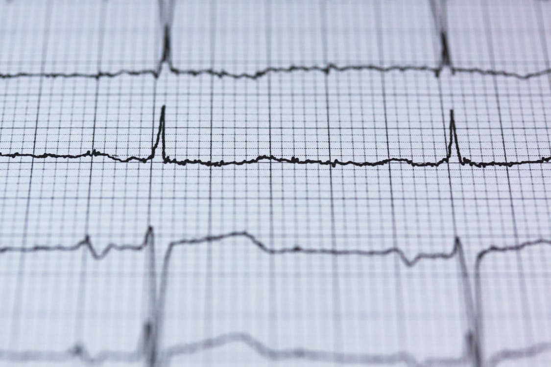 Heart-Rate-Graph