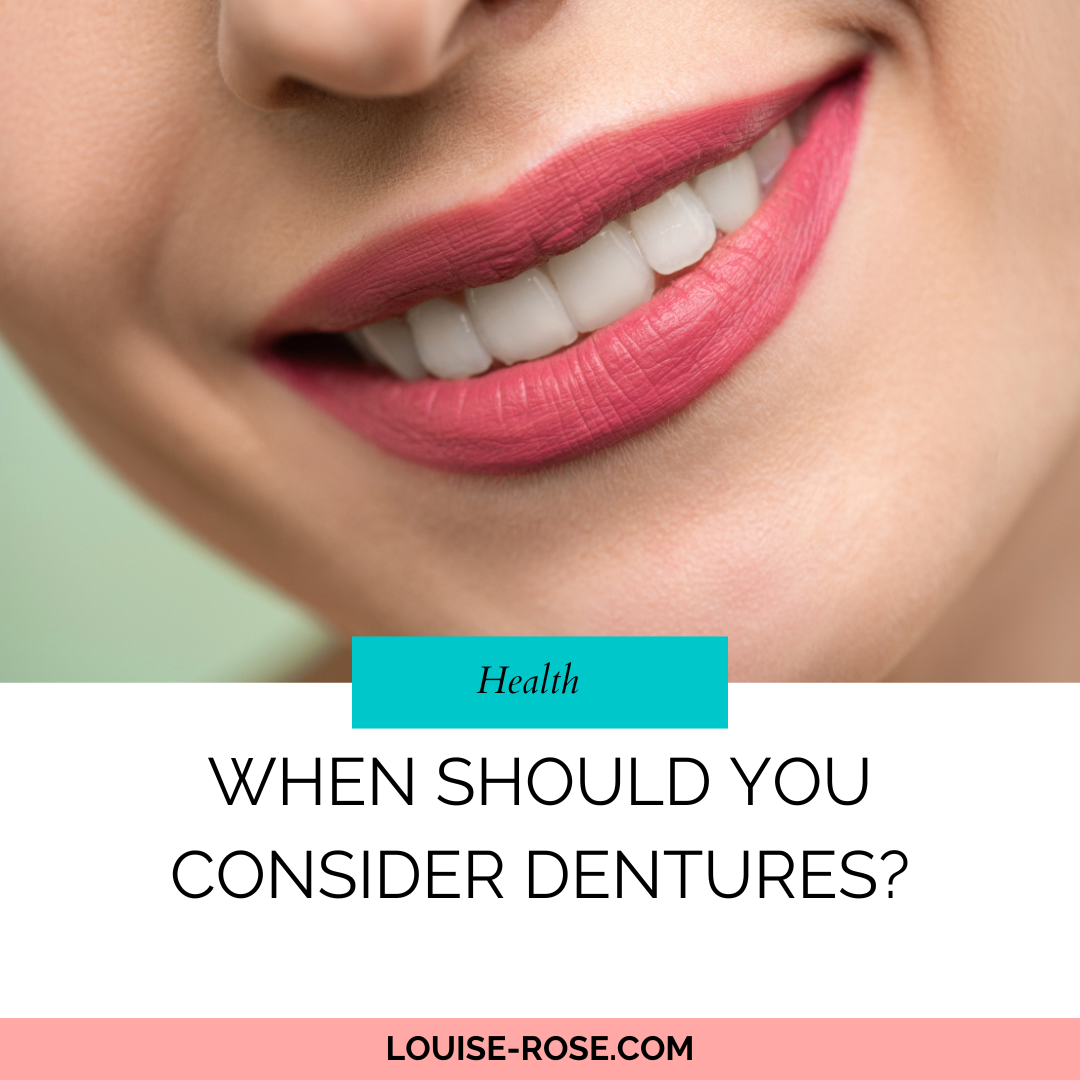 When Should You Consider Dentures?